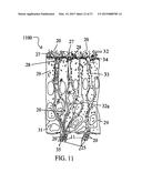 ALZHEIMER S DISEASE TREATMENT WITH MULTIPLE THERAPEUTIC AGENTS DELIVERED     TO THE OLFACTORY REGION THROUGH A SPECIAL DELIVERY CATHETER AND     IONTOPHORESIS diagram and image