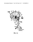 ALZHEIMER S DISEASE TREATMENT WITH MULTIPLE THERAPEUTIC AGENTS DELIVERED     TO THE OLFACTORY REGION THROUGH A SPECIAL DELIVERY CATHETER AND     IONTOPHORESIS diagram and image