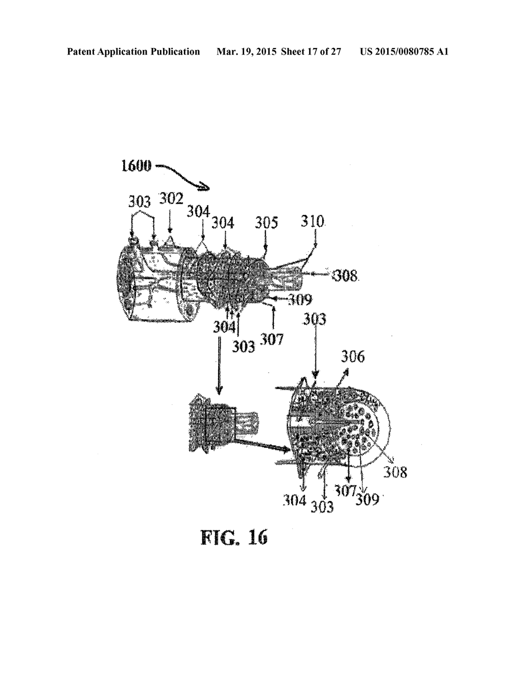 ALZHEIMER'S DISEASE TREATMENT WITH MULTIPLE THERAPEUTIC AGENTS DELIVERED     TO THE OLFACTORY REGION THROUGH A SPECIAL DELIVERY CATHETER AND     IONTOPHORESIS - diagram, schematic, and image 18