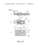 ALZHEIMER S DISEASE TREATMENT WITH MULTIPLE THERAPEUTIC AGENTS DELIVERED     TO THE OLFACTORY REGION THROUGH A SPECIAL DELIVERY CATHETER AND     IONTOPHORESIS diagram and image