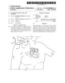 ANCHOR INSTRUMENTATION AND METHODS diagram and image