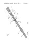 ANCHOR INSTRUMENTATION AND METHODS diagram and image