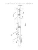 ANCHOR INSTRUMENTATION AND METHODS diagram and image