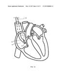 ANCHOR INSTRUMENTATION AND METHODS diagram and image