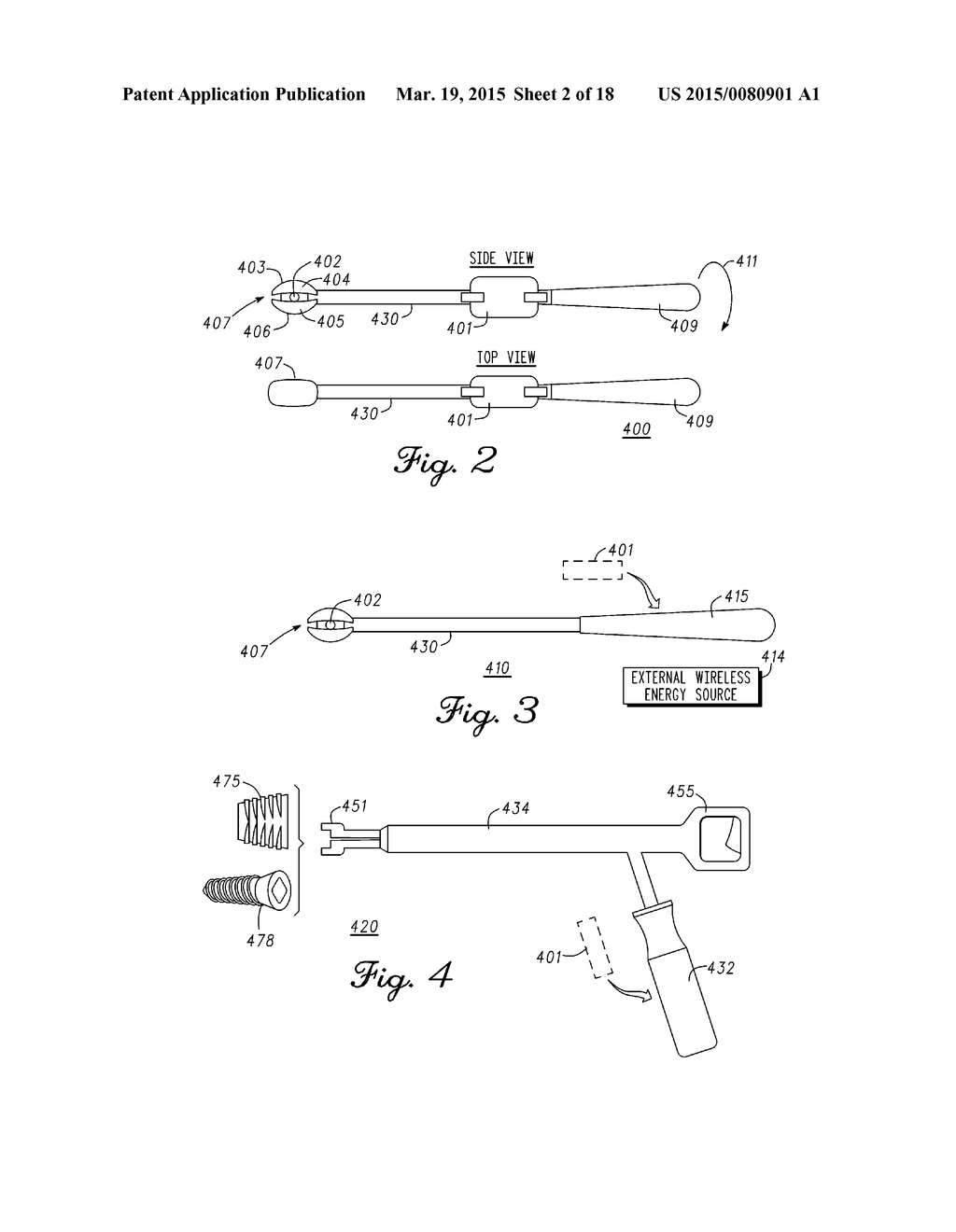 DEVICE AND METHOD FOR ENABLING AN ORTHOPEDIC TOOL FOR PARAMETER     MEASUREMENT - diagram, schematic, and image 03