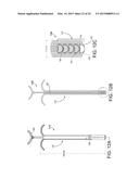 BIOABSORBABLE CLIPS AND APPLICATOR FOR TISSUE CLOSURE diagram and image