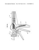 Surgical Clip and Applier Device and Method of Use diagram and image