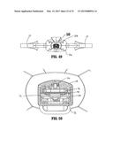 APPARATUS FOR APPLYING SURGICAL CLIPS diagram and image