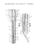 APPARATUS FOR APPLYING SURGICAL CLIPS diagram and image