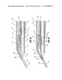 APPARATUS FOR APPLYING SURGICAL CLIPS diagram and image