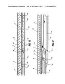 APPARATUS FOR APPLYING SURGICAL CLIPS diagram and image