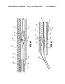 APPARATUS FOR APPLYING SURGICAL CLIPS diagram and image