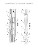 APPARATUS FOR APPLYING SURGICAL CLIPS diagram and image