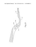 ALIGNMENT FEATURES FOR ULTRASONIC SURGICAL INSTRUMENT diagram and image