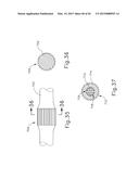 ALIGNMENT FEATURES FOR ULTRASONIC SURGICAL INSTRUMENT diagram and image