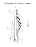 ALIGNMENT FEATURES FOR ULTRASONIC SURGICAL INSTRUMENT diagram and image