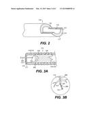 ENDOVASCULAR DEVICES AND METHODS FOR EXPLOITING INTRAMURAL SPACE diagram and image