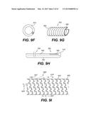 ENDOVASCULAR DEVICES AND METHODS FOR EXPLOITING INTRAMURAL SPACE diagram and image