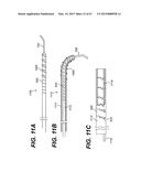 ENDOVASCULAR DEVICES AND METHODS FOR EXPLOITING INTRAMURAL SPACE diagram and image