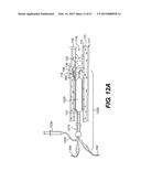 ENDOVASCULAR DEVICES AND METHODS FOR EXPLOITING INTRAMURAL SPACE diagram and image