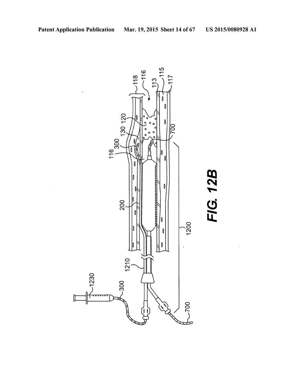 ENDOVASCULAR DEVICES AND METHODS FOR EXPLOITING INTRAMURAL SPACE - diagram, schematic, and image 15