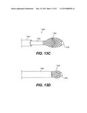 ENDOVASCULAR DEVICES AND METHODS FOR EXPLOITING INTRAMURAL SPACE diagram and image