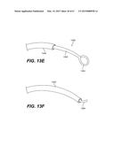 ENDOVASCULAR DEVICES AND METHODS FOR EXPLOITING INTRAMURAL SPACE diagram and image