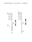 ENDOVASCULAR DEVICES AND METHODS FOR EXPLOITING INTRAMURAL SPACE diagram and image