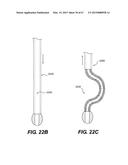 ENDOVASCULAR DEVICES AND METHODS FOR EXPLOITING INTRAMURAL SPACE diagram and image