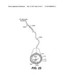 ENDOVASCULAR DEVICES AND METHODS FOR EXPLOITING INTRAMURAL SPACE diagram and image