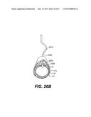 ENDOVASCULAR DEVICES AND METHODS FOR EXPLOITING INTRAMURAL SPACE diagram and image