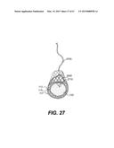 ENDOVASCULAR DEVICES AND METHODS FOR EXPLOITING INTRAMURAL SPACE diagram and image