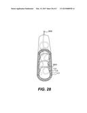 ENDOVASCULAR DEVICES AND METHODS FOR EXPLOITING INTRAMURAL SPACE diagram and image