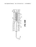 ENDOVASCULAR DEVICES AND METHODS FOR EXPLOITING INTRAMURAL SPACE diagram and image