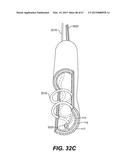 ENDOVASCULAR DEVICES AND METHODS FOR EXPLOITING INTRAMURAL SPACE diagram and image