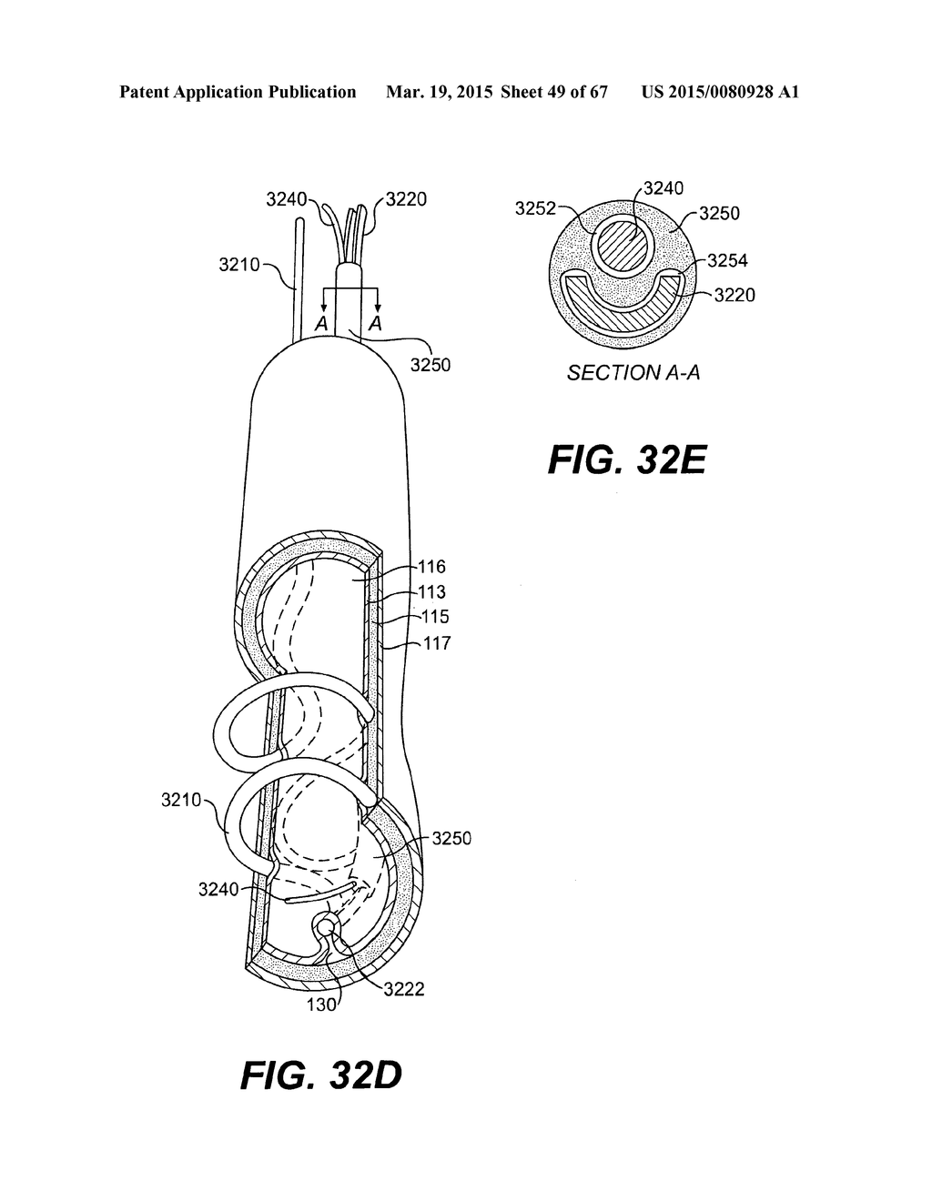 ENDOVASCULAR DEVICES AND METHODS FOR EXPLOITING INTRAMURAL SPACE - diagram, schematic, and image 50