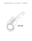 ENDOVASCULAR DEVICES AND METHODS FOR EXPLOITING INTRAMURAL SPACE diagram and image