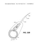 ENDOVASCULAR DEVICES AND METHODS FOR EXPLOITING INTRAMURAL SPACE diagram and image