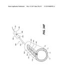 ENDOVASCULAR DEVICES AND METHODS FOR EXPLOITING INTRAMURAL SPACE diagram and image