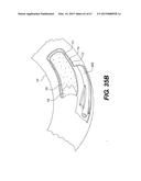 ENDOVASCULAR DEVICES AND METHODS FOR EXPLOITING INTRAMURAL SPACE diagram and image