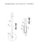 ENDOVASCULAR DEVICES AND METHODS FOR EXPLOITING INTRAMURAL SPACE diagram and image