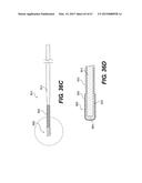 ENDOVASCULAR DEVICES AND METHODS FOR EXPLOITING INTRAMURAL SPACE diagram and image