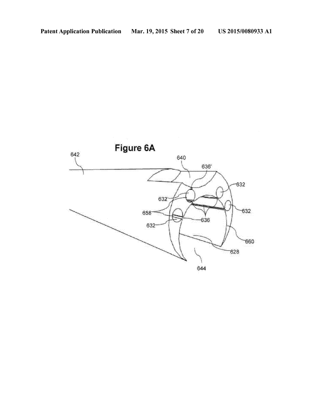 ENDOSCOPE WITH SHARED WORKING CHANNEL - diagram, schematic, and image 08