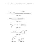 Minimally Invasive Lung Volume Reduction Devices, Methods, and Systems diagram and image