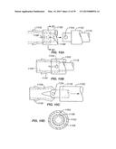 Minimally Invasive Lung Volume Reduction Devices, Methods, and Systems diagram and image