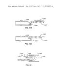 Minimally Invasive Lung Volume Reduction Devices, Methods, and Systems diagram and image