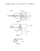 Minimally Invasive Lung Volume Reduction Devices, Methods, and Systems diagram and image