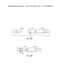 Minimally Invasive Lung Volume Reduction Devices, Methods, and Systems diagram and image