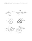 Minimally Invasive Lung Volume Reduction Devices, Methods, and Systems diagram and image