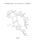 Minimally Invasive Lung Volume Reduction Devices, Methods, and Systems diagram and image